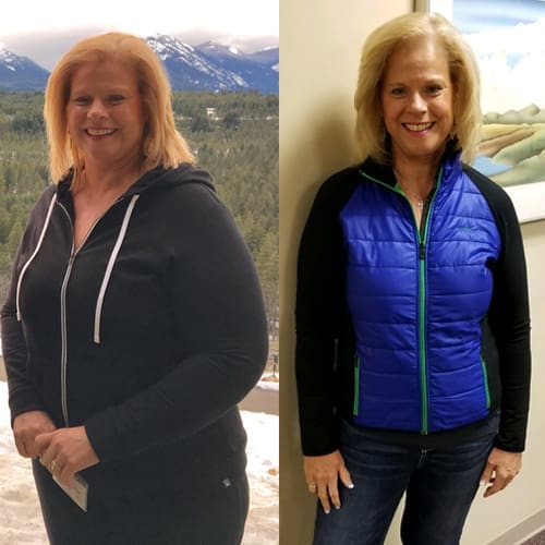 Lorrie Before & After